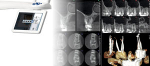radiologia stomatologiczna RTG zębów Medicodent Kielce