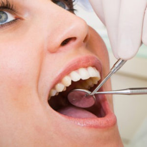 przeglądy stanu uzębienia - stomatologia zachowawcza