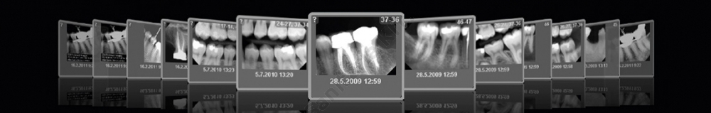obrazowanie stomatologiczne - prześwietlenie zębów RTG